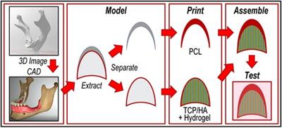 A dual osteoconductive-osteoprotective implantable device for vertical alveolar ridge augmentation